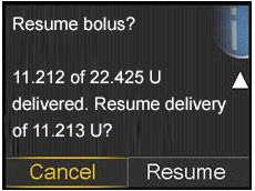 Resume bolus screen