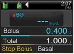 Bolus confirmation screen