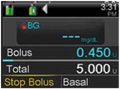 Select stop bolus screen