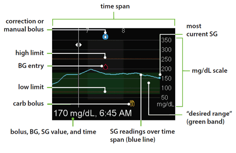 Parts of the sensor graph