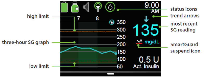 Reading Your Sensor Graphs