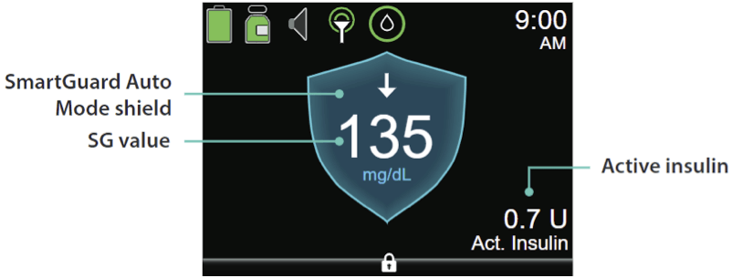 Reading Your Sensor Graphs