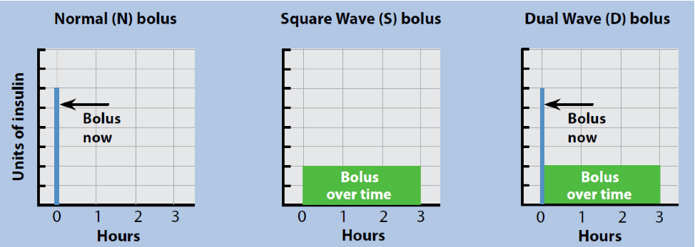 Bolus Types