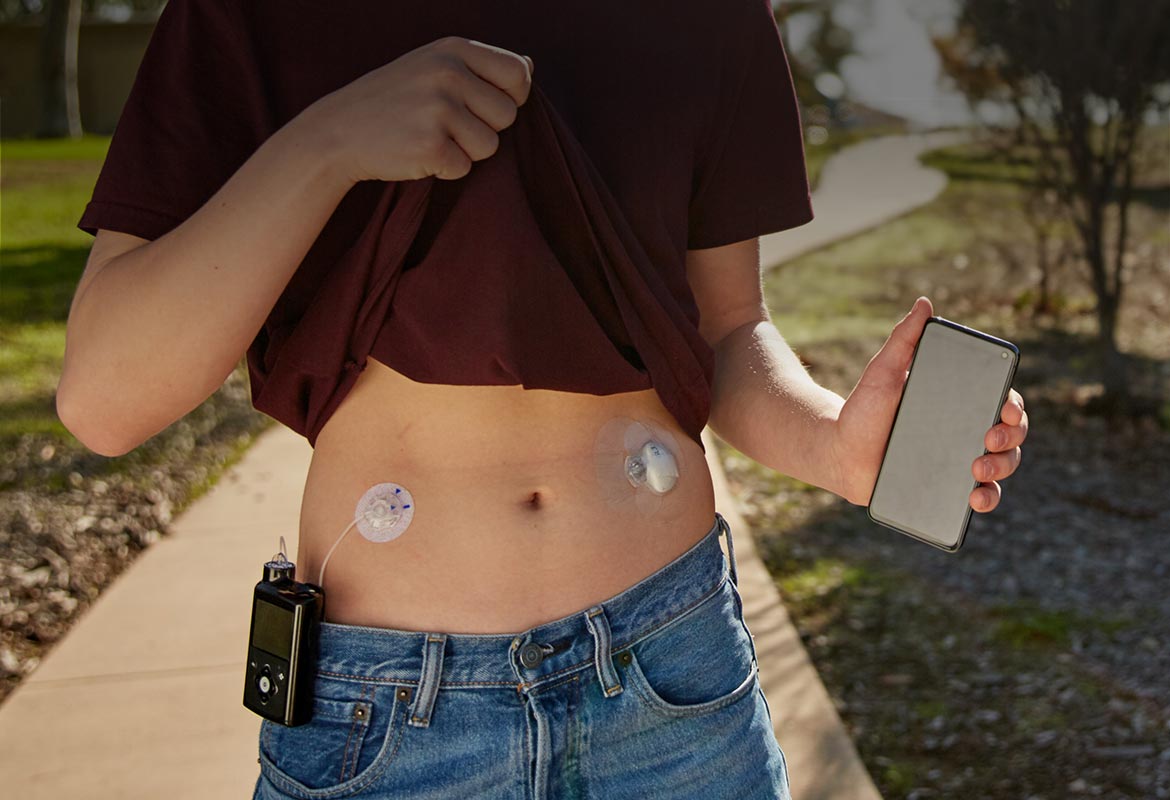 Insulin-delivery patch monitors and manages glucose levels | The Engineer The Engineer