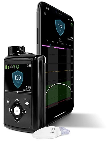 The MiniMed 770G insulin pump system