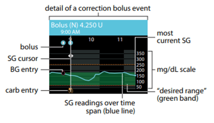 Detail of a correction bolus event