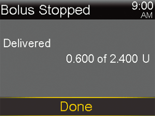 Bolus stopped screen