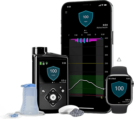 CGM with automated insulin pump system