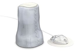 Mio Advance Infusion Set