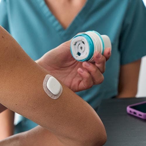Simplera CGM on arm