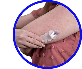 Champion Monique insertion arm taping1