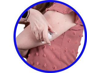 Champion Monique insertion arm taping3