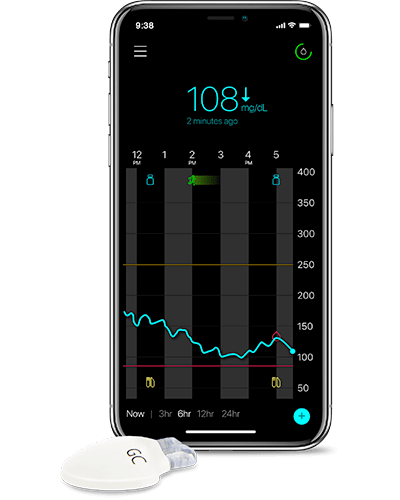 benefits of CGM