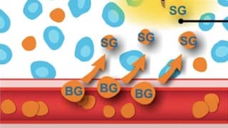 illustration of blood glucose and sensor glucose