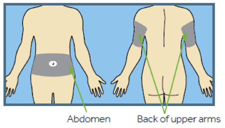 insertion sites