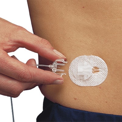 MiniMed™ Silhouette™ infusion set