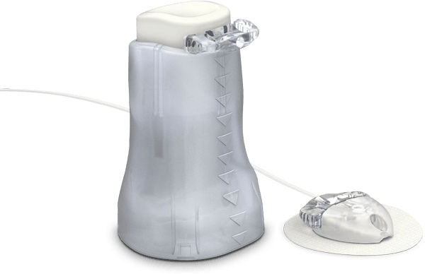 Medtronic Mio™ Advance infusion Set