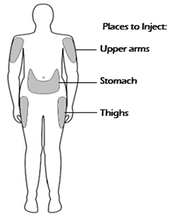 places to inject