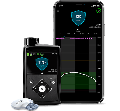 The MiniMed 770G insulin pump system