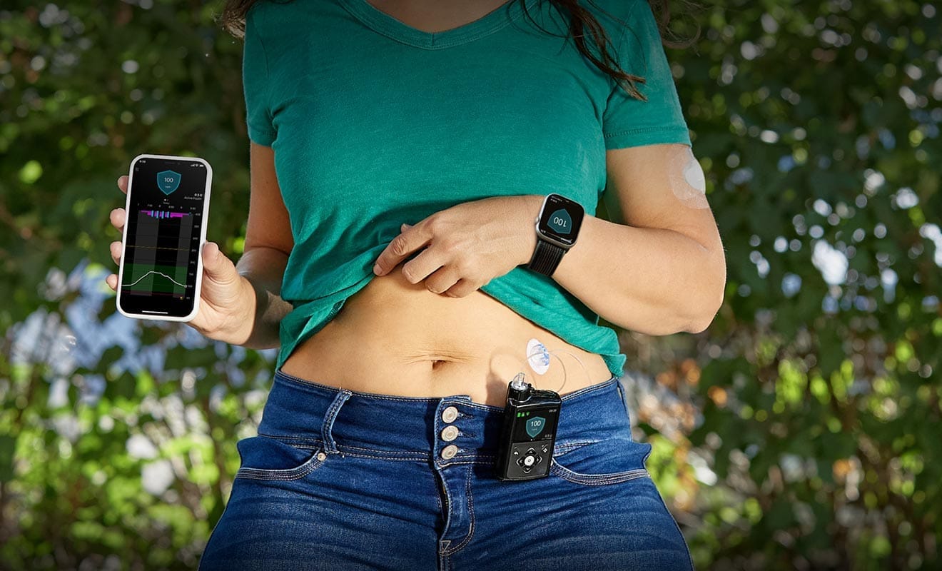 Insulin Pump Therapy