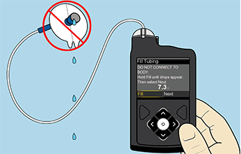 Insulin dripping after priming illustration