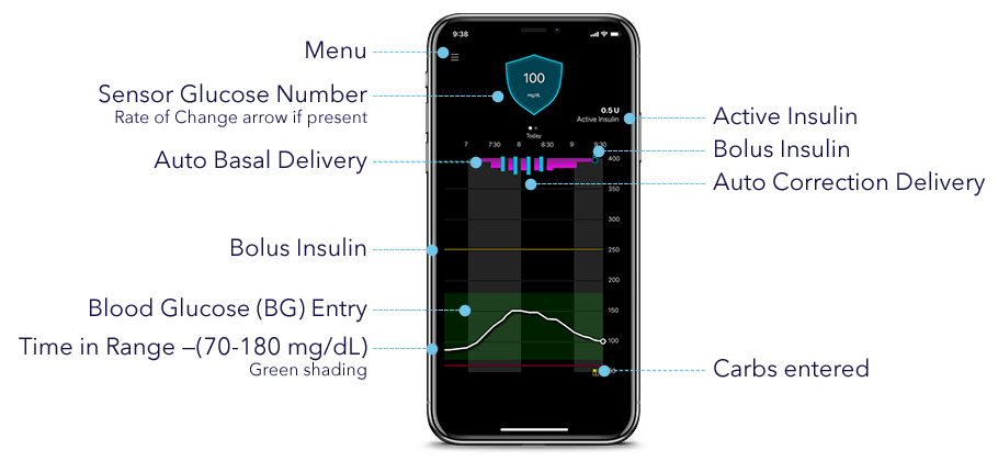 MiniMed Mobile App Home Screen