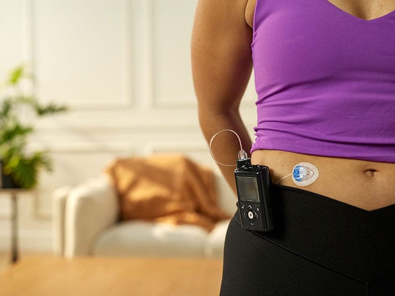 Medtronic Extended™ infusion set with longer tubing