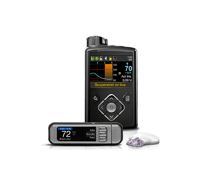 MiniMed 630G system with optional CGM