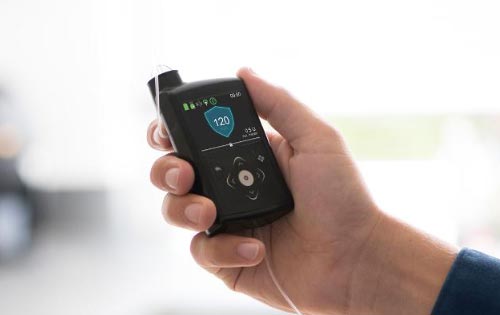 Success with SmartGuard™ Auto Mode