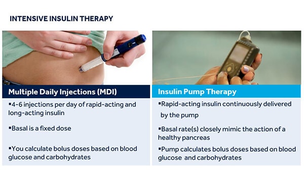 Basics of Insulin Pump Therapy