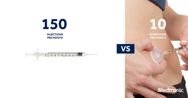 150 injections per month vs. 10 insertions per month