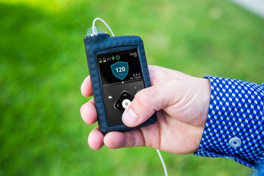 Person holding MiniMed 670G insulin pump