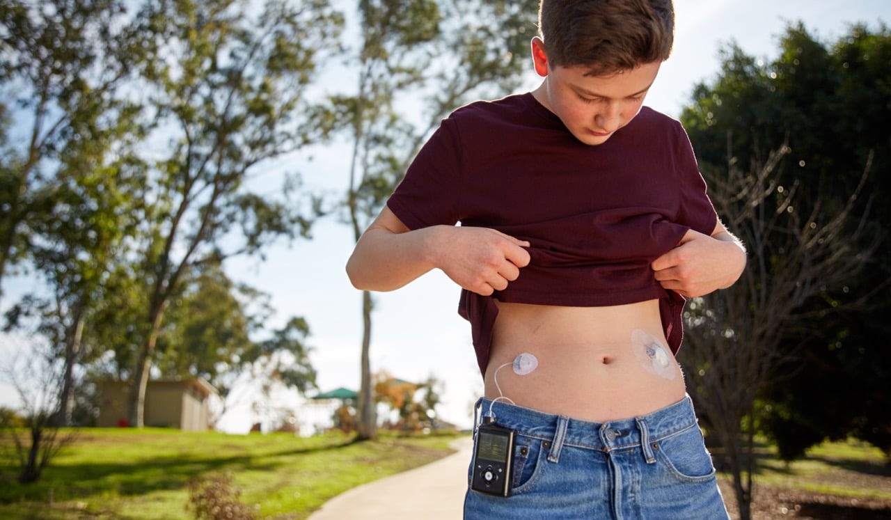 Medtronic insulin pump on boy