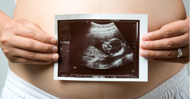 pregnant person holding ultrasound