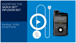 Using the Quick-set & 670G Insulin Pump